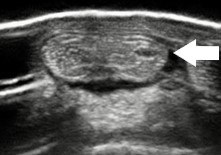 Ultrasound of the back of the pastern showing tendinitis of the deep digital flexor tendon. 