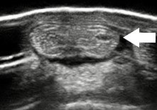 Ultrasound of the back of the pastern showing tendinitis of the deep digital flexor tendon.