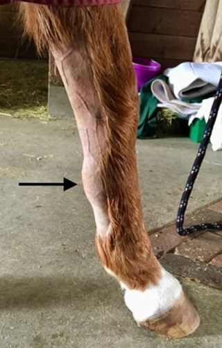 A bowed tendon on the front leg of horse, called tendinitis of the superficial digital flexor tendon which is firm, swollen, and warm to touch.