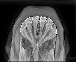 radiograph shows teeth not affected by EOTRH