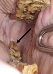 Malocclusion 2